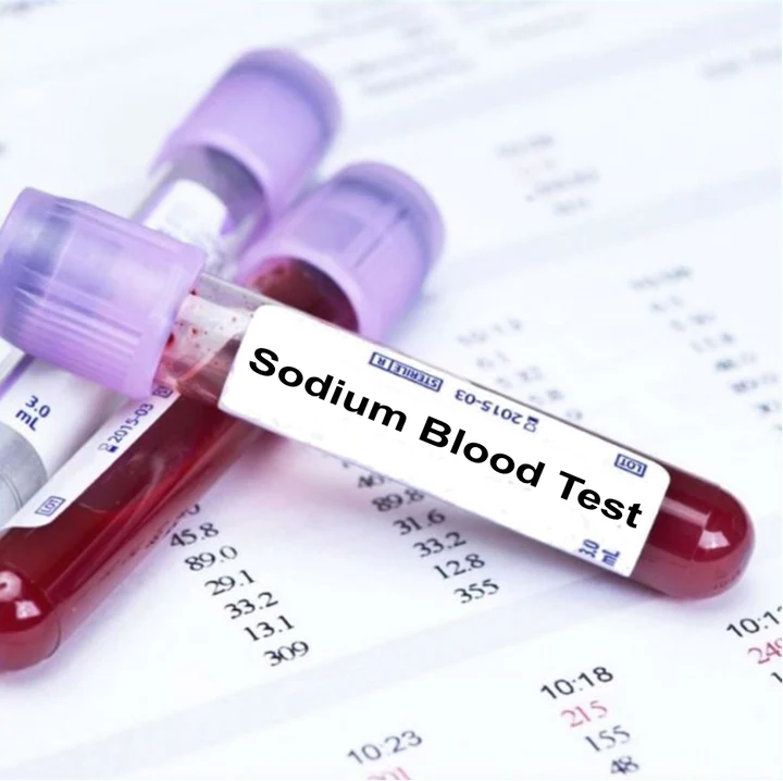 Sodium is an electrolyte of vital importance in the human organism. It is acquired by food and it is secreted by sweat and by the kidneys. Its function is critical in acid-balance mechanism and contributes in neuromuscular functioning.