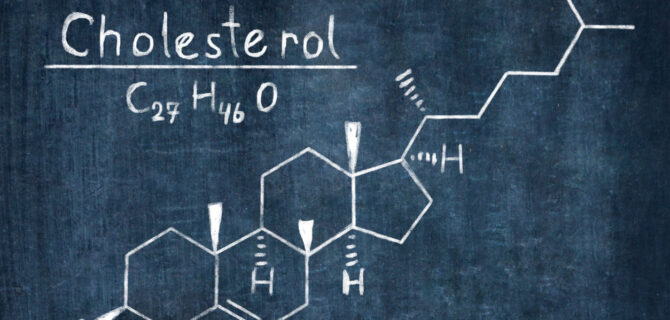 Chemical Formula of Cholesterol concept on Blackboard