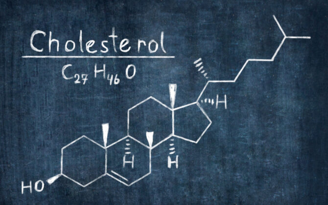 Chemical Formula of Cholesterol concept on Blackboard