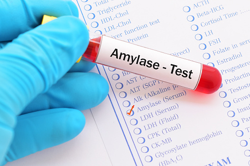 Amylase is an enzyme found in the salivary glands and in the pancreas. It is also found in smaller quantity in other tissues. It hydrolyzes complex carbohydrates in the small intestine, assisting thus in digestion.