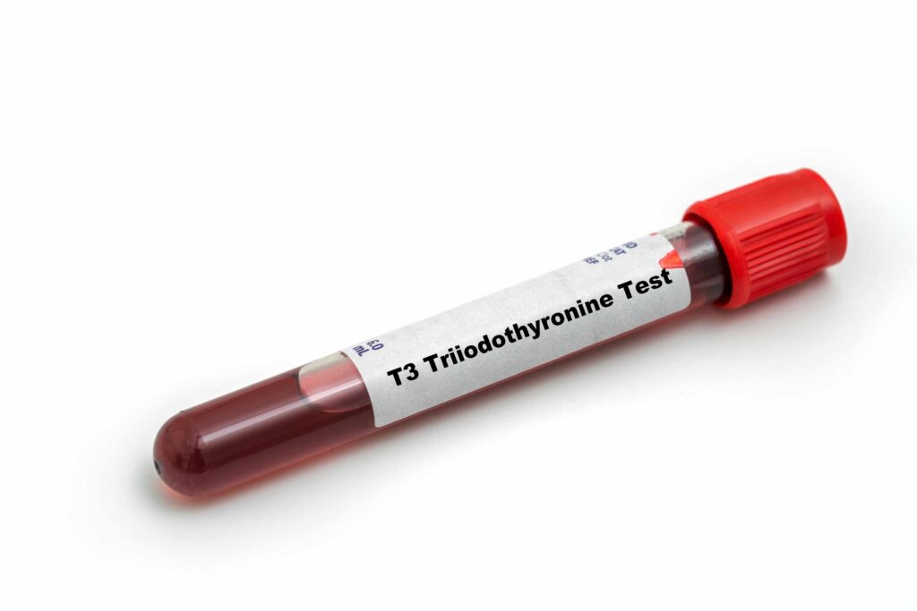 Η Τ3 είναι ορμόνη η οποία παράγεται κατά 20% από τον θυρεοειδή αδένα και κατά 80% στους περιφερικούς ιστούς από τη μετατροπή της θυροξίνης (Τ4) σε Τ3 (αποϊωδίωση).